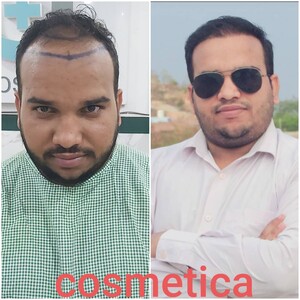 Image of Cosmetica India Gallery 3