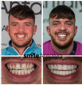 Image of Smile Antalya Dental Gallery 0