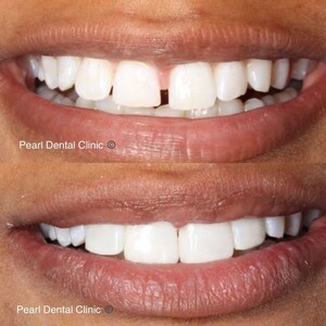 Image of Pearl Dental Clinic Gallery 0