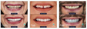 Image of Omer Istanbul Dental Center Gallery 1