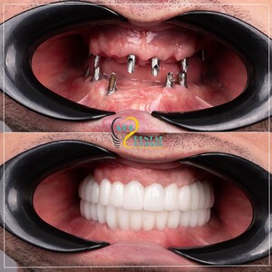 Image of AEG Dental Clinic International Gallery 1