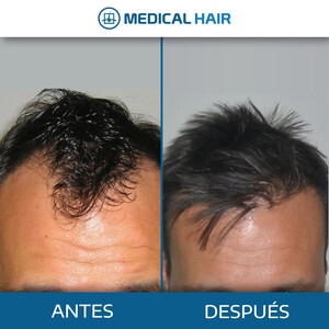 Image of Medical Hair Spain Gallery 3