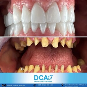 Image of DCA - Dental Center Albania Gallery 1