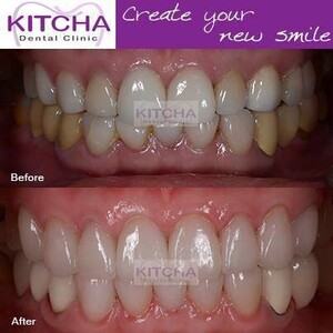 Image of Kitcha Dental Clinic Gallery 2