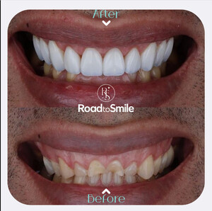 Image of Road to Smile Gallery 1