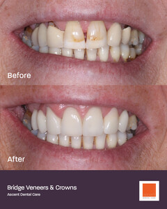 Image of Ascent Dental Care Gallery 0