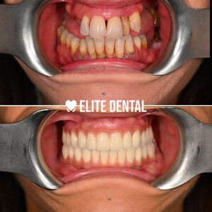 Image of Dentista Albania - Elite Dental Gallery 0