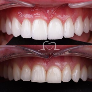 Image of Best Dental Istanbul Gallery 1