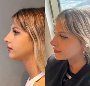 Image of Dr. Enis Ekincioğlu Istanbul Rhinoplasty Clinic Gallery 3