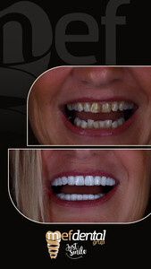 Image of Mefdental Global Gallery 0