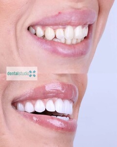 Image of Positive Dental Studio Gallery 2