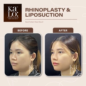 Image of KALO Cosmetic Surgery Gallery 2