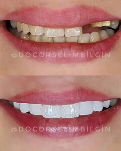 Image of Pro Estetik Dental Clinic - Selim Bilgin Gallery 2