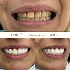 Image of Smile makeover