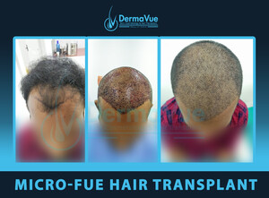 Image of DermaVue Skin, Cosmetology & Hair Transplant Gallery 2