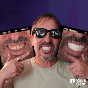 Image of Before and after dental treatment