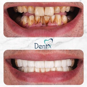 Image of Dent X Dental Polyclinic Gallery 0