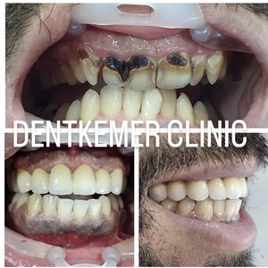 Image of Dentkemer Dental Clinic Gallery 0