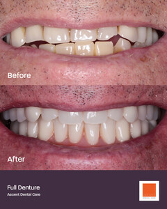 Image of Ascent Dental Care Gallery 3