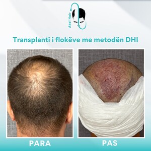 Image of Akel Hair Clinic Tirana Gallery 0