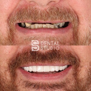 Image of BS Dental Studio Gallery 1