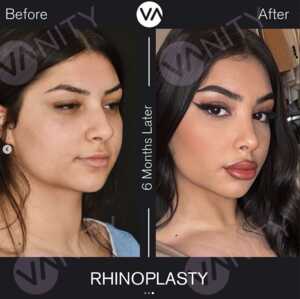 Image of Vanity Cosmetic Surgery Hospital Gallery 1