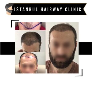 Image of İstanbul Hairway Clinic Gallery 1