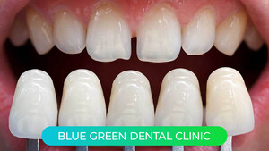 Image of Blue Green Dental Clinic Gallery 0