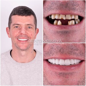 Image of Dentavrasya Dental Clinic Istanbul Turkey Gallery 3