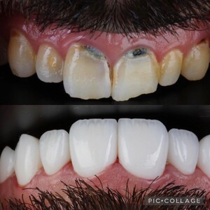 Image of Smile makeover