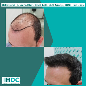 Image of HDC Hair Clinic Gallery 3