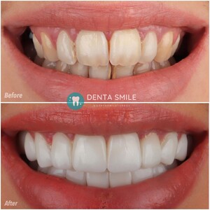 Image of DentaSmile Turkey Gallery 2