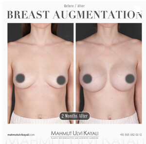 Image of Mahmut Ulvi Kayalı MD. Aesthetic Surgeon Gallery 0