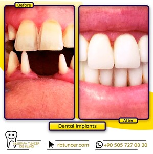 Image of Mustafa Tuncer Dental Clinic Gallery 3