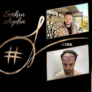 Image of Serkan Aydin Hair Clinic Gallery 1