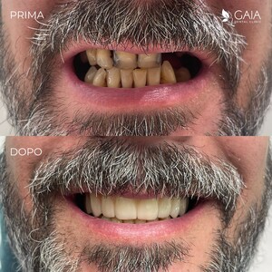 Image of Smile makeover