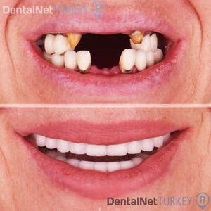 Image of Dental Net Turkey Gallery 1