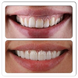 Image of Creadenta Dental Clinic Gallery 1