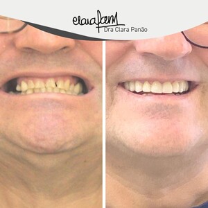 Image of Smile makeover