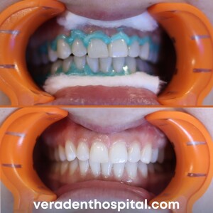 Image of Vera Dental Clinic Gallery 2