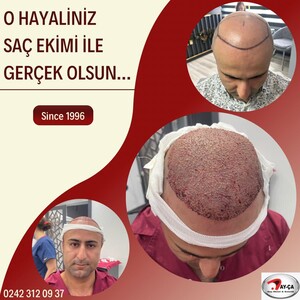 Image of AY-ÇA Hair Transplantation & Aesthetics Gallery 1