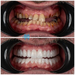 Image of Medic Antalya Dental Clinic Gallery 2