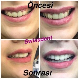 Image of Swiss Dent Oral and Dental Health Polyclinic Gallery 3