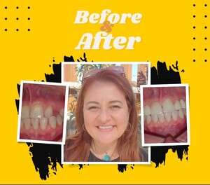 Image of Smile transformation