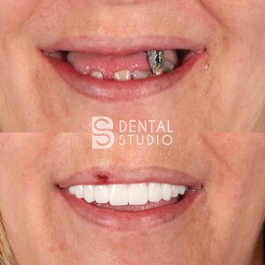 Image of BS Dental Studio Gallery 0