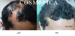 Image of Cosmetica Hair Clinic Gallery 2