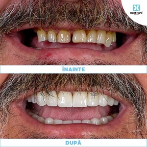 Image of Before after dental treatments - Dent Park