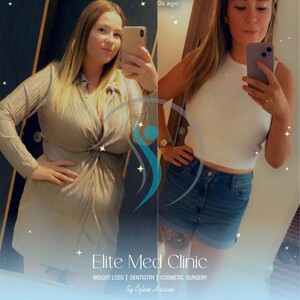 Image of Weight Loss Surgery Elite Med Clinic