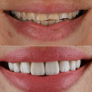 Image of Creative Smiles Turkey (CS) Dental Clinic Gallery 2