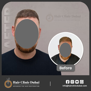 Image of The Hair Clinic Dubai Gallery 1